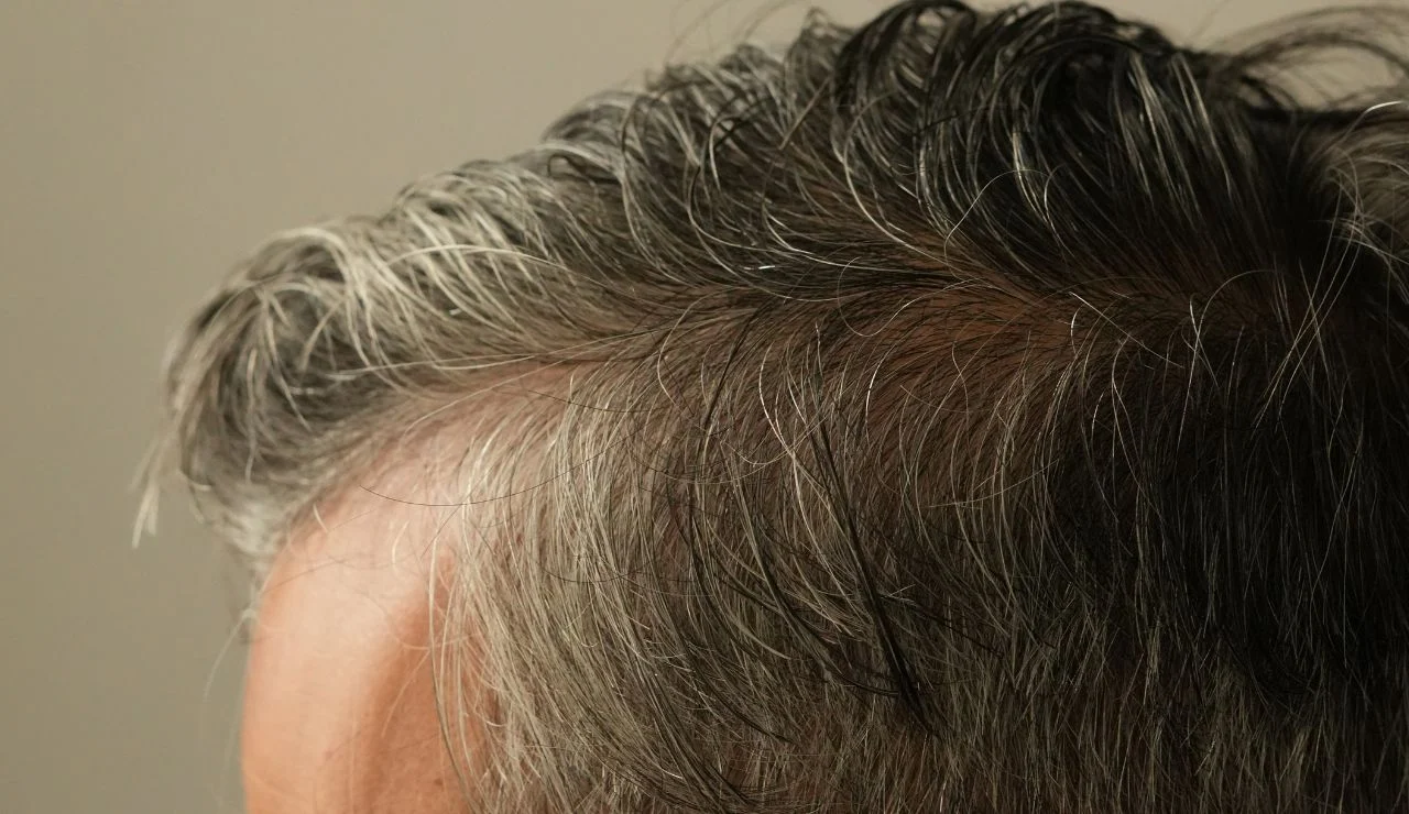 Penyebab rambut lepek pada kulit kepala